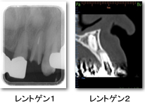 パークゴルフ場