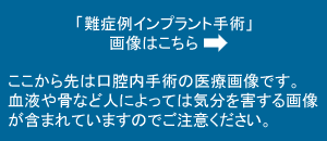 難症例インプラント手術画像へ